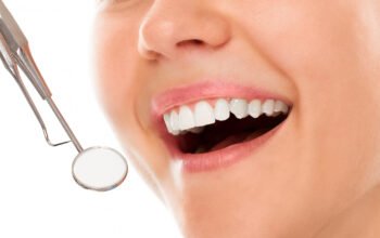 Best Dental Implant Centre In Faridabad